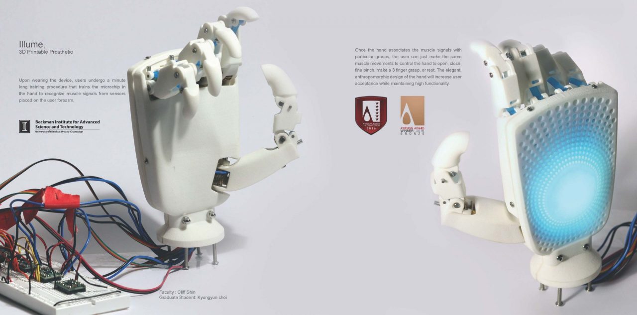 Closeup of Illume, a 3D Printable Prosthetic